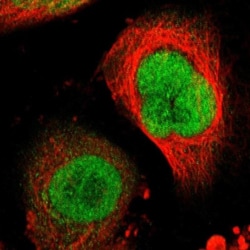 RRP7A Antibody, Novus Biologicals 25 &mu;L; Unlabeled:Antibodies, Polyclonal